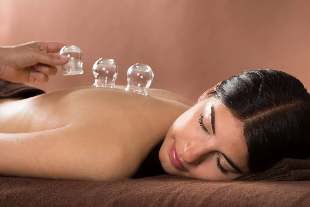 Woman Lying On Front Receiving Cupping Treatment On Back