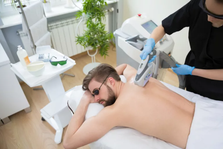 How Should You Prepare for Laser Hair Removal?