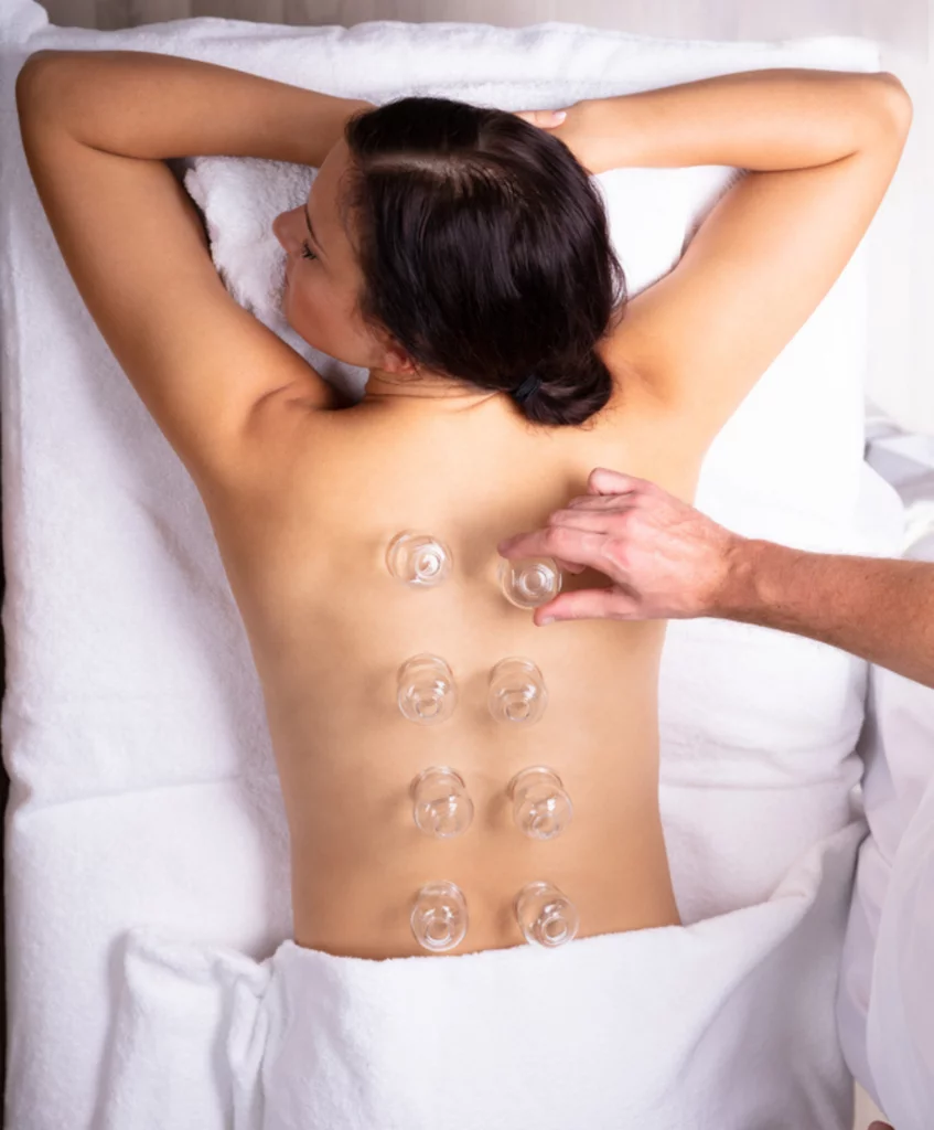 What is Cupping & How Does It Work?