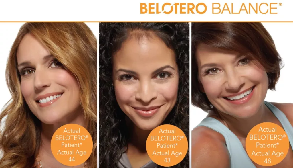 Belotero Balance - BEFORE + AFTER SERIES OF ACTUAL PATIENTS