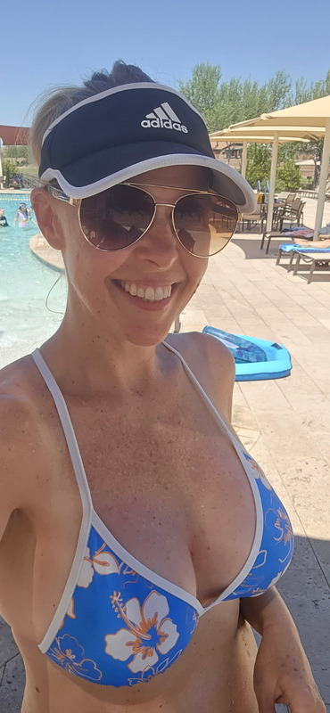 After Breast Augmentation